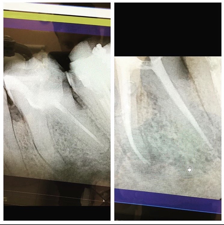 TK Dental Wayne Dentists Wayne, NJ Dr. Tatyana Kaminar, DDS