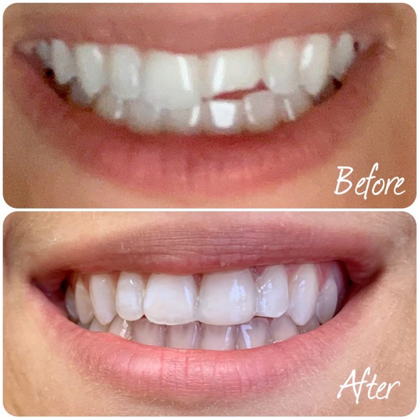 TK Dental Wayne Dentists Wayne, NJ Dr. Tatyana Kaminar, DDS