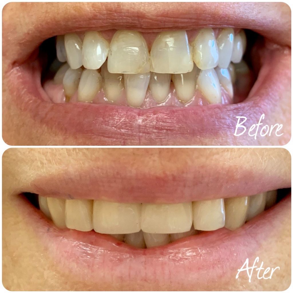 TK Dental Wayne Dentists Wayne, NJ Dr. Tatyana Kaminar, DDS