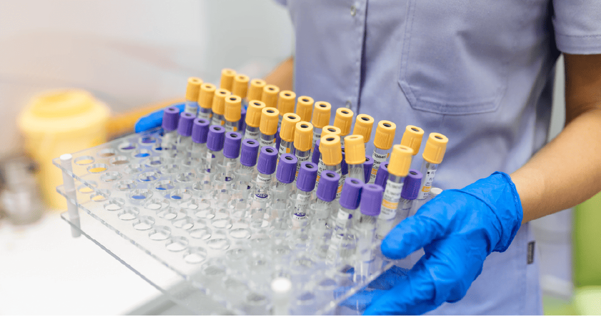 Specimen Collection Service TLC Udon Lab Center