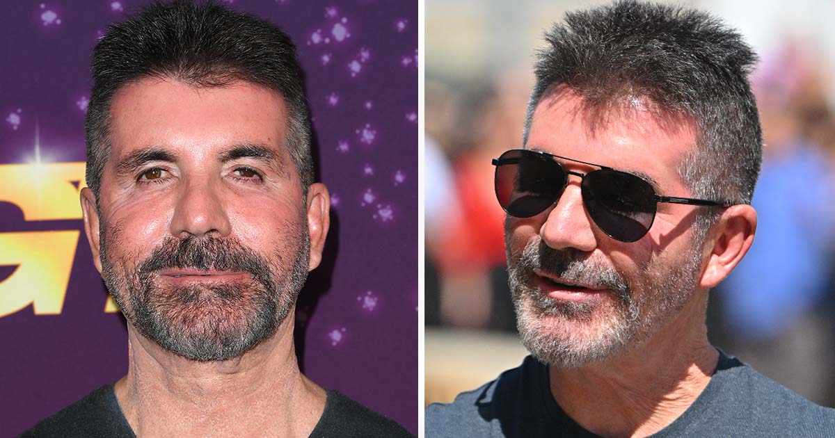 Simon Cowell’s Journey From Accident to Recovery