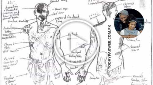 Kobe And Gigi Autopsy Report Kobe Bryant Autopsy Report