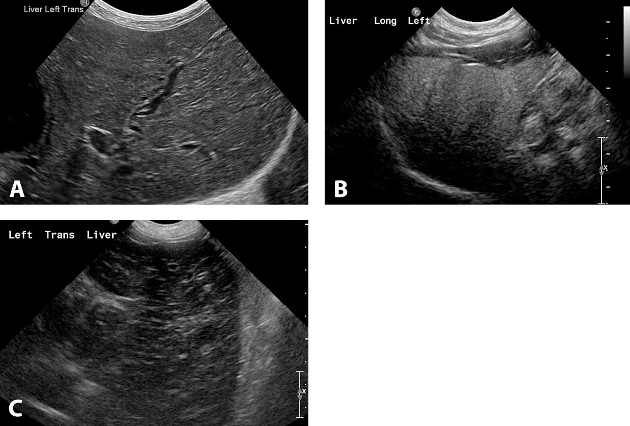 Small Animal Abdominal Ultrasonography, Part 2 Liver and Gallbladder