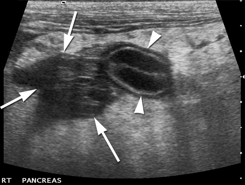 From Diagnosis to Treatment A Case of Canine Acute Pancreatitis