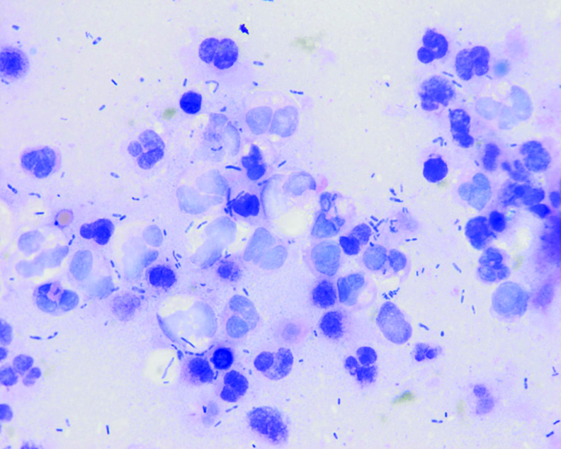 Neutrophilic Cholangitis in Cats Today's Veterinary Practice