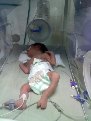 Historias Prematuros Todo Para Prematuros