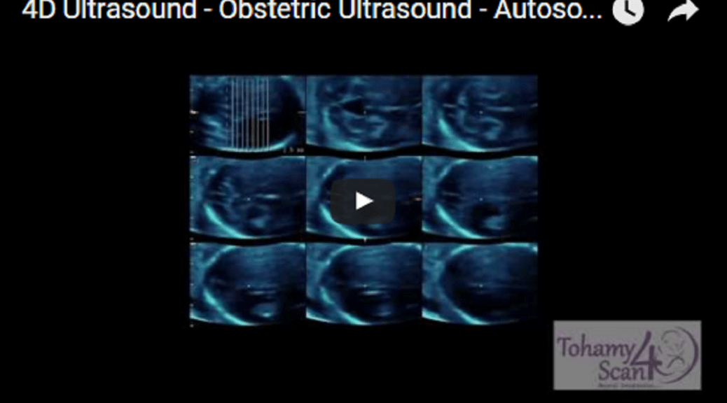 4D Ultrasound Obstetric Ultrasound Autosomal Recessive Polycystic