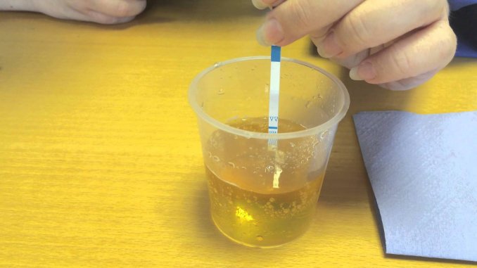 Interesting Can A Drug Test Detect Pregnancy?