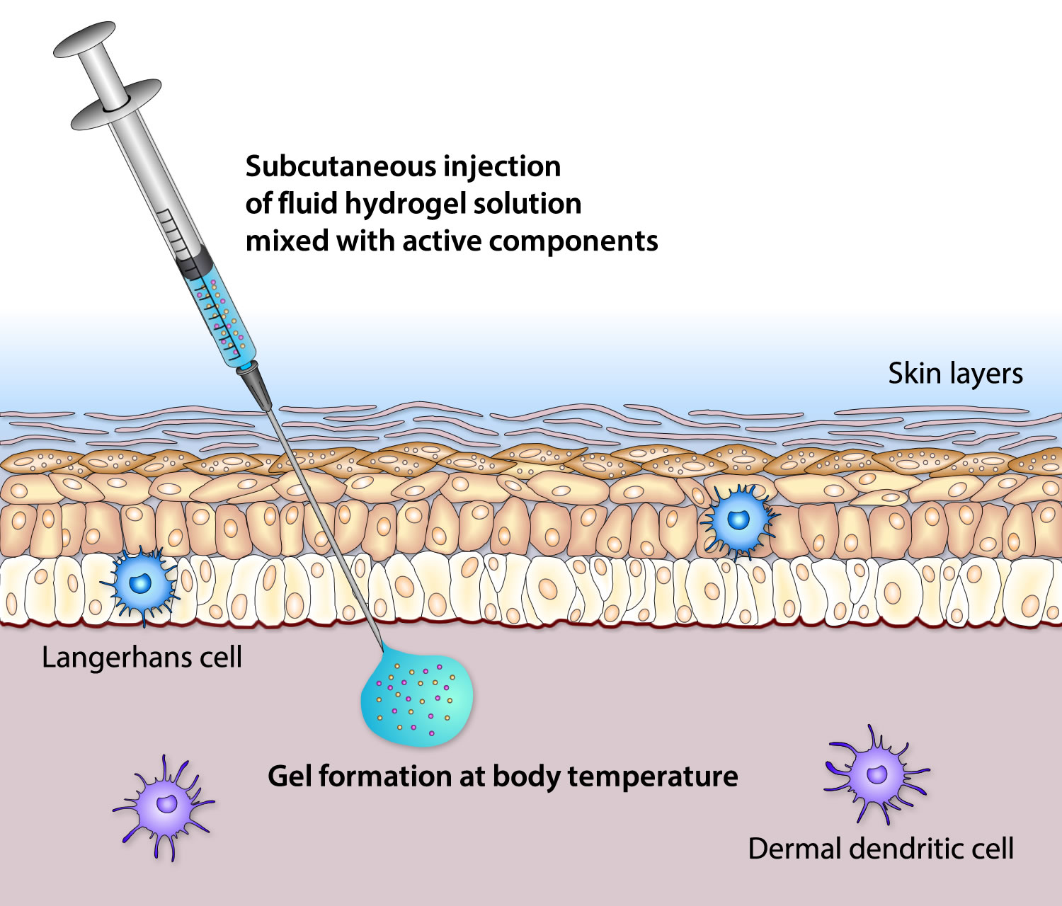 Hydrogel technology Tolerogenics S.a.r.l.