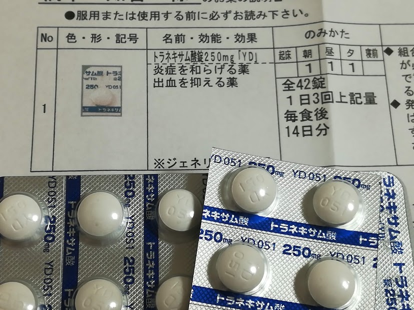 肝斑治療は皮膚科で保険適用可能？内服薬トラネキサム酸処方の費用は？ その後どうよ？アラフォーtomomoのぶっちゃけ！