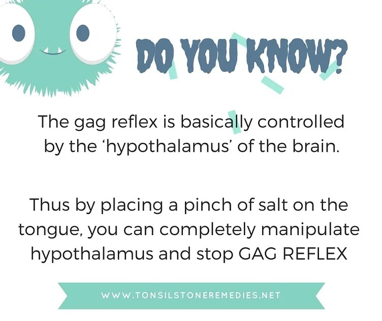Home Remedies To Get Tonsil Stones Out Without Gagging (gag reflex)