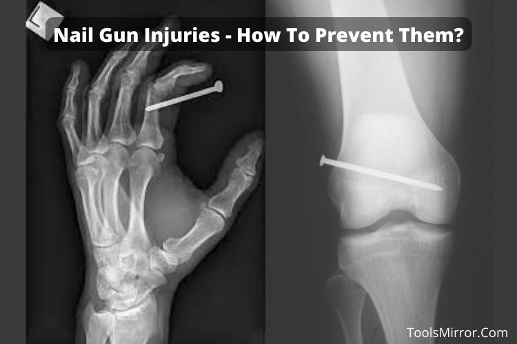 The Most Common Nail Gun Injuries And How To Prevent Them? Tools Mirror