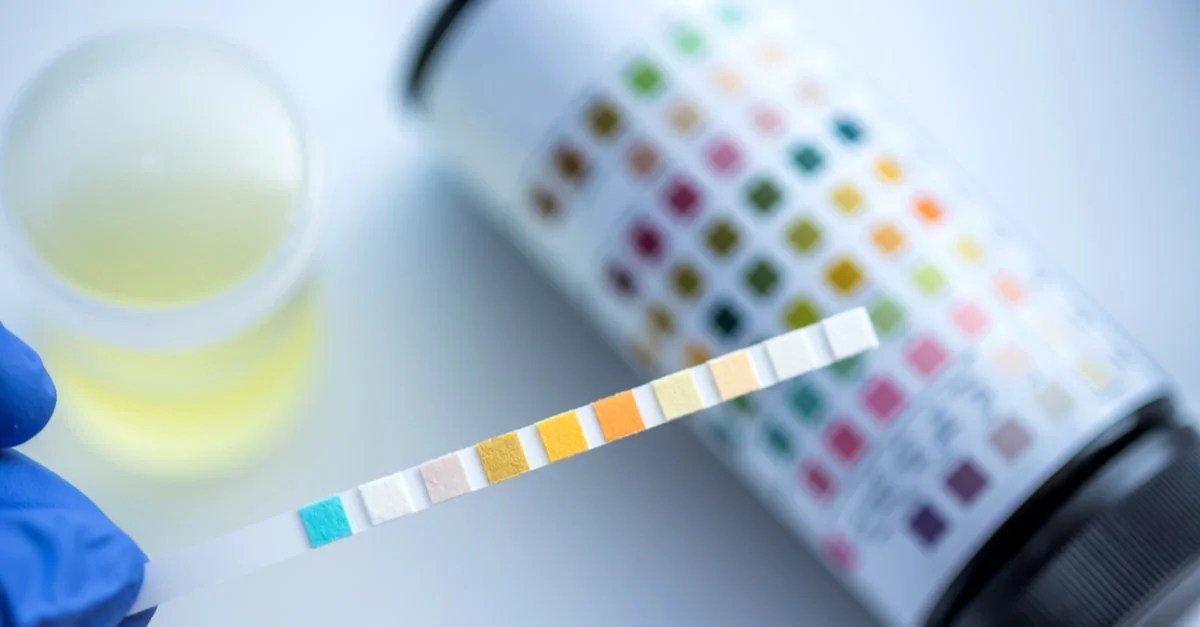 Does Lowe’s Drug Test? March 2022