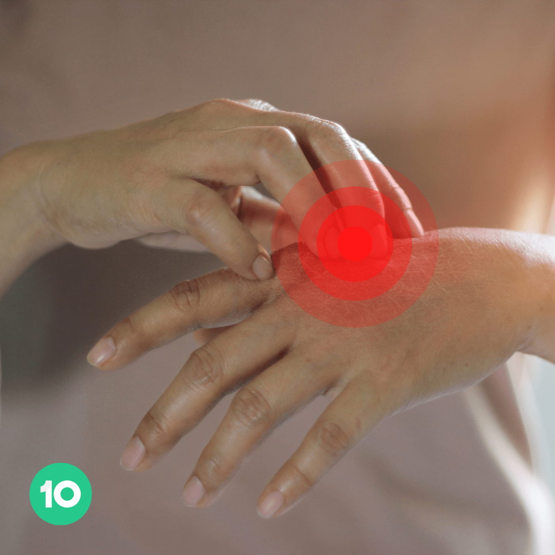 What are the early signs of psoriasis?