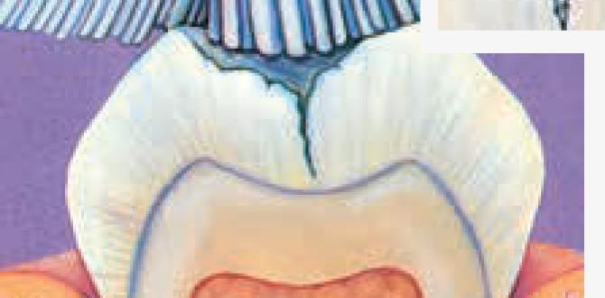 what is the primary purpose of pit and fissure sealants what is the primary purpose of pit and fissure sealants
