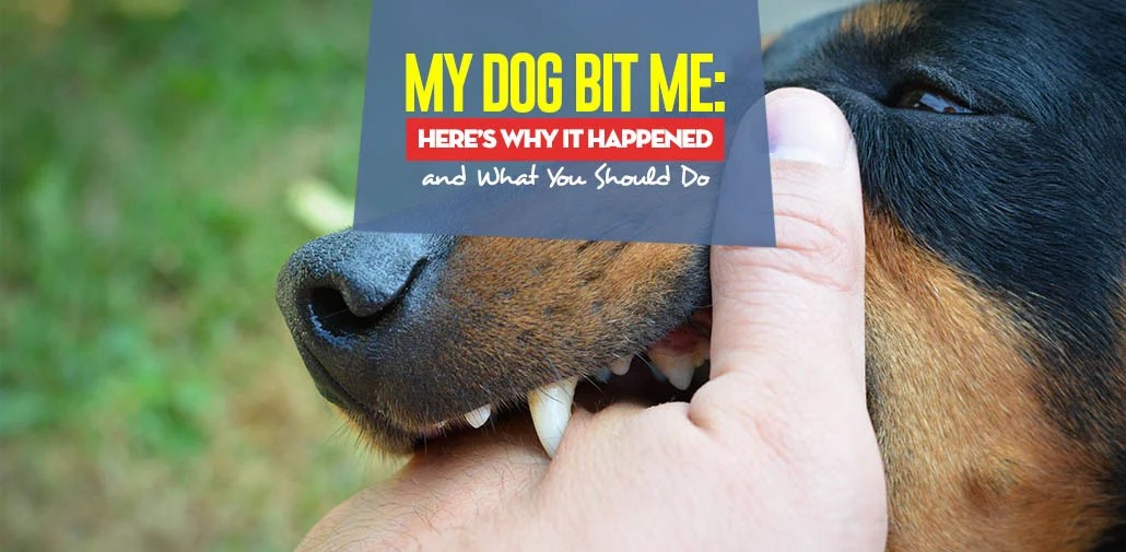 My Dog Keeps Biting Me For No Reason at David Lombardo blog