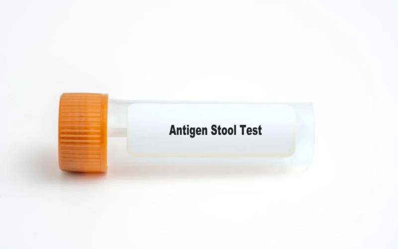 Fecal Test for Dogs What It Is, Costs, and More
