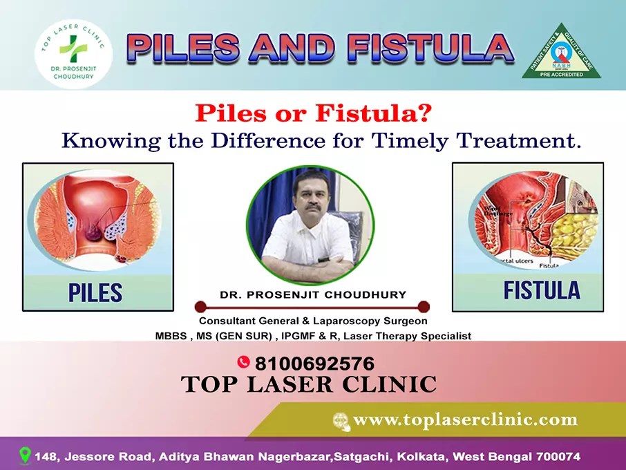 Piles and fistula difference