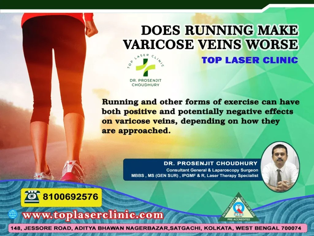 Does running make varicose veins worse? Top Laser Clinic