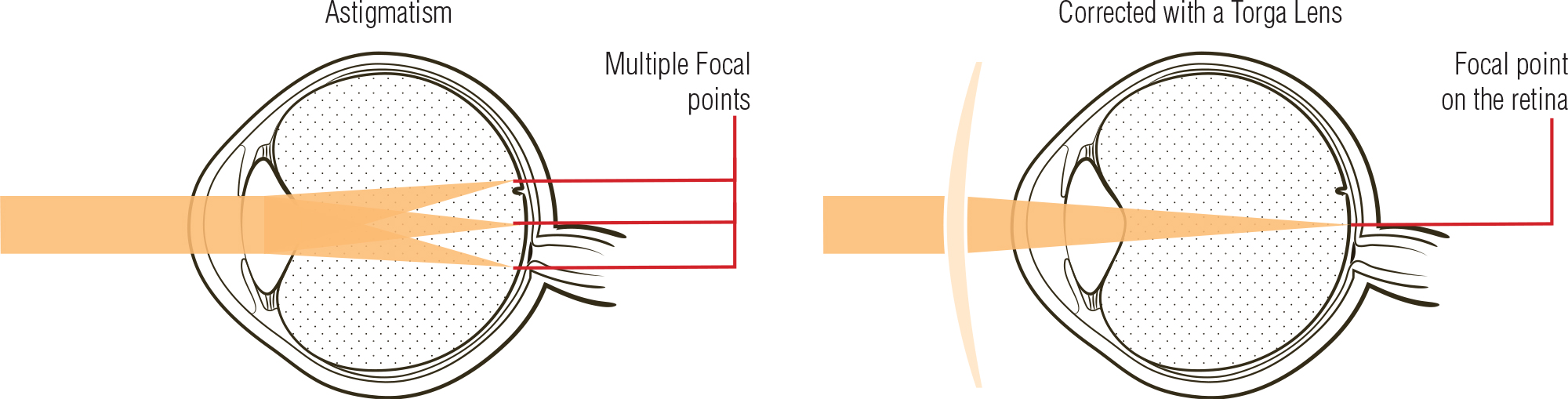 Prescription Sunglasses With Astigmatism at Mildred Mcclary blog