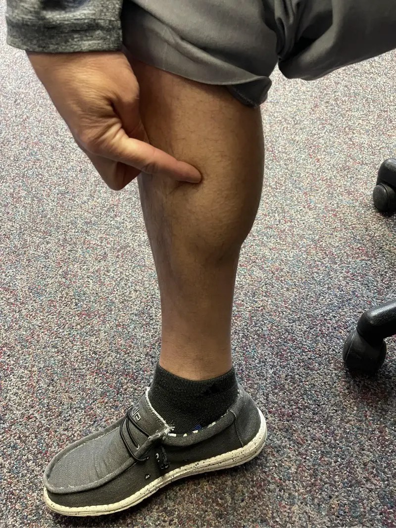 Calf Cramps How to STOP Calf Cramps