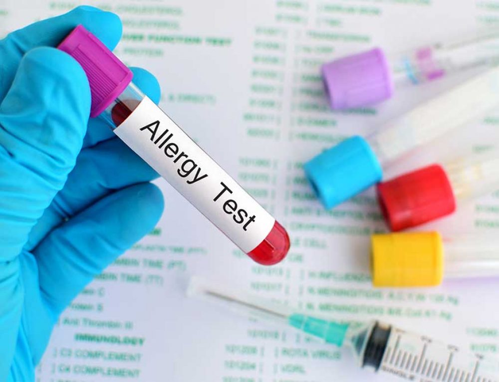 Symptoms of Food Allergies Tottori Allergy & Asthma Associates