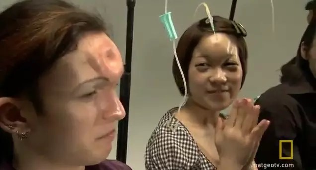 Bagel Heads The Stupid New Trend in Body Modification