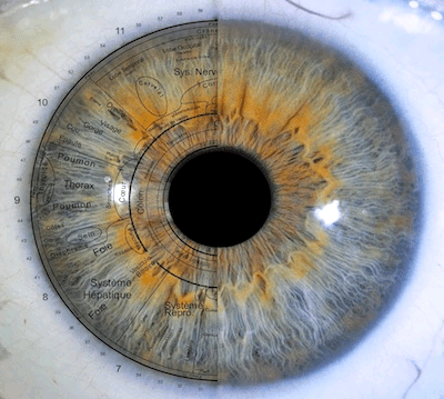 Interpretation Tpe Iridologie