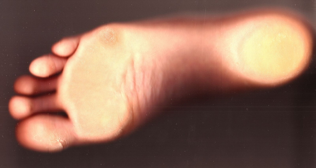 Tracy Kemp Podiatry in Bendigo who does foot assessments