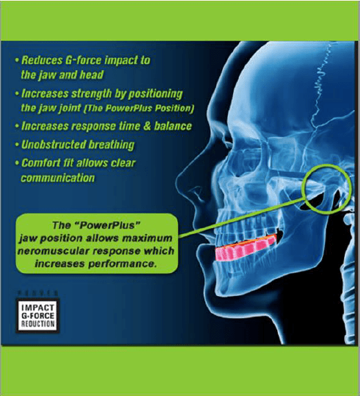 New Studies Reveal How Mouthguards Can Reduce Concussions Training & Conditioning