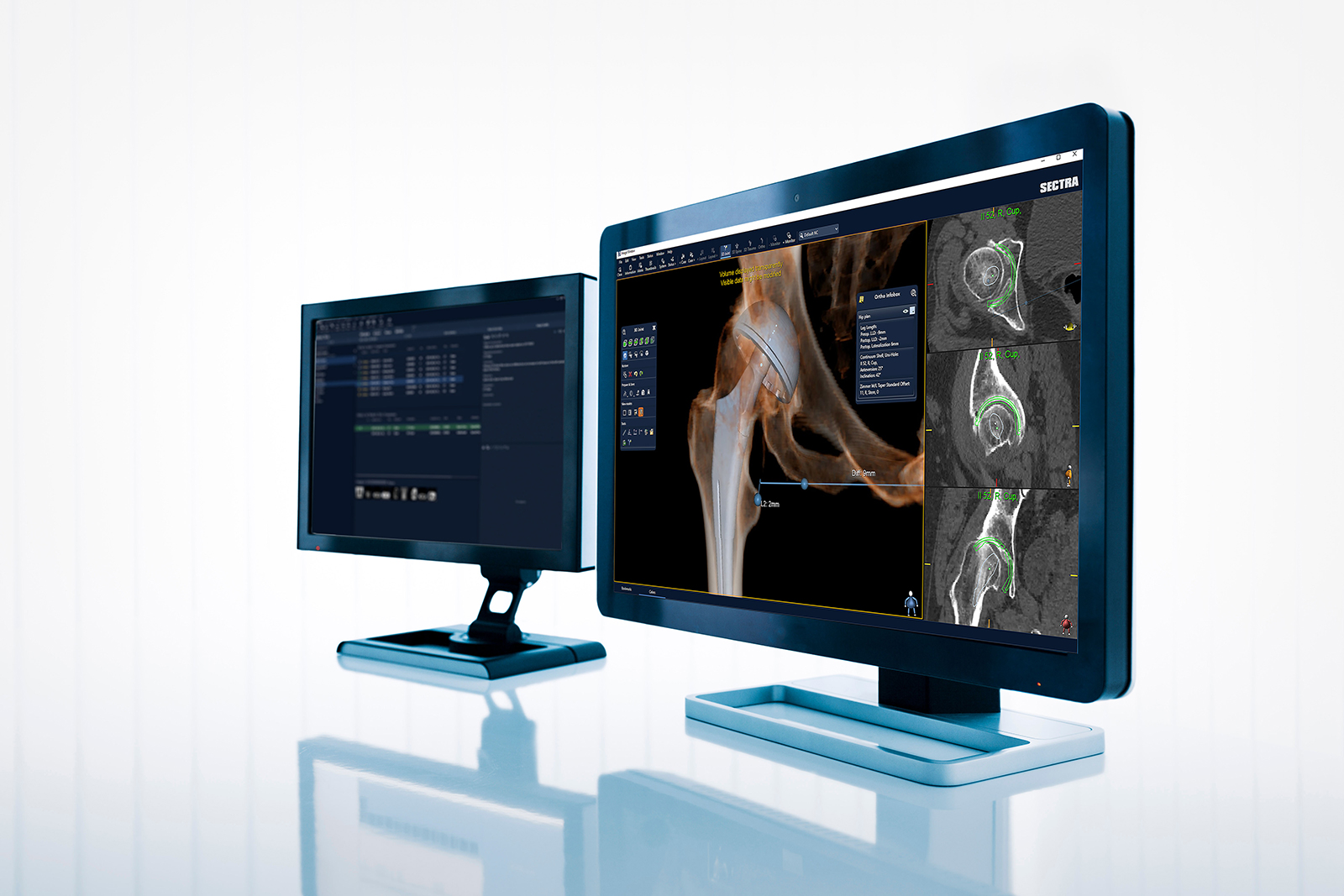 Orthopaedics & MSK Radiology NA (redirect from global) Sectra