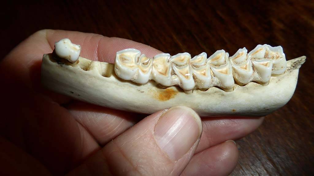 Tooth Decay Causes, Symptoms, Treatment and Prevention