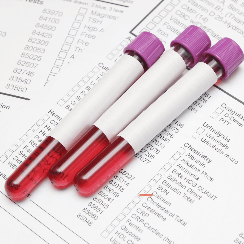 Blood Test Analysis TransformNow