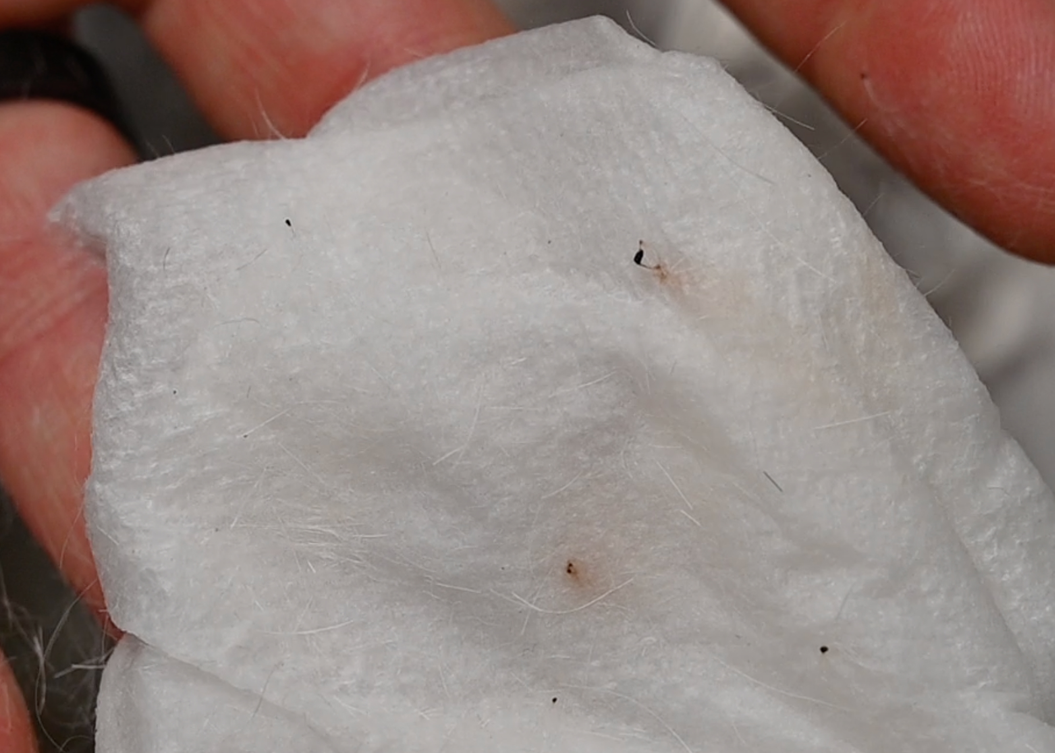 Flea Poop On Sheets