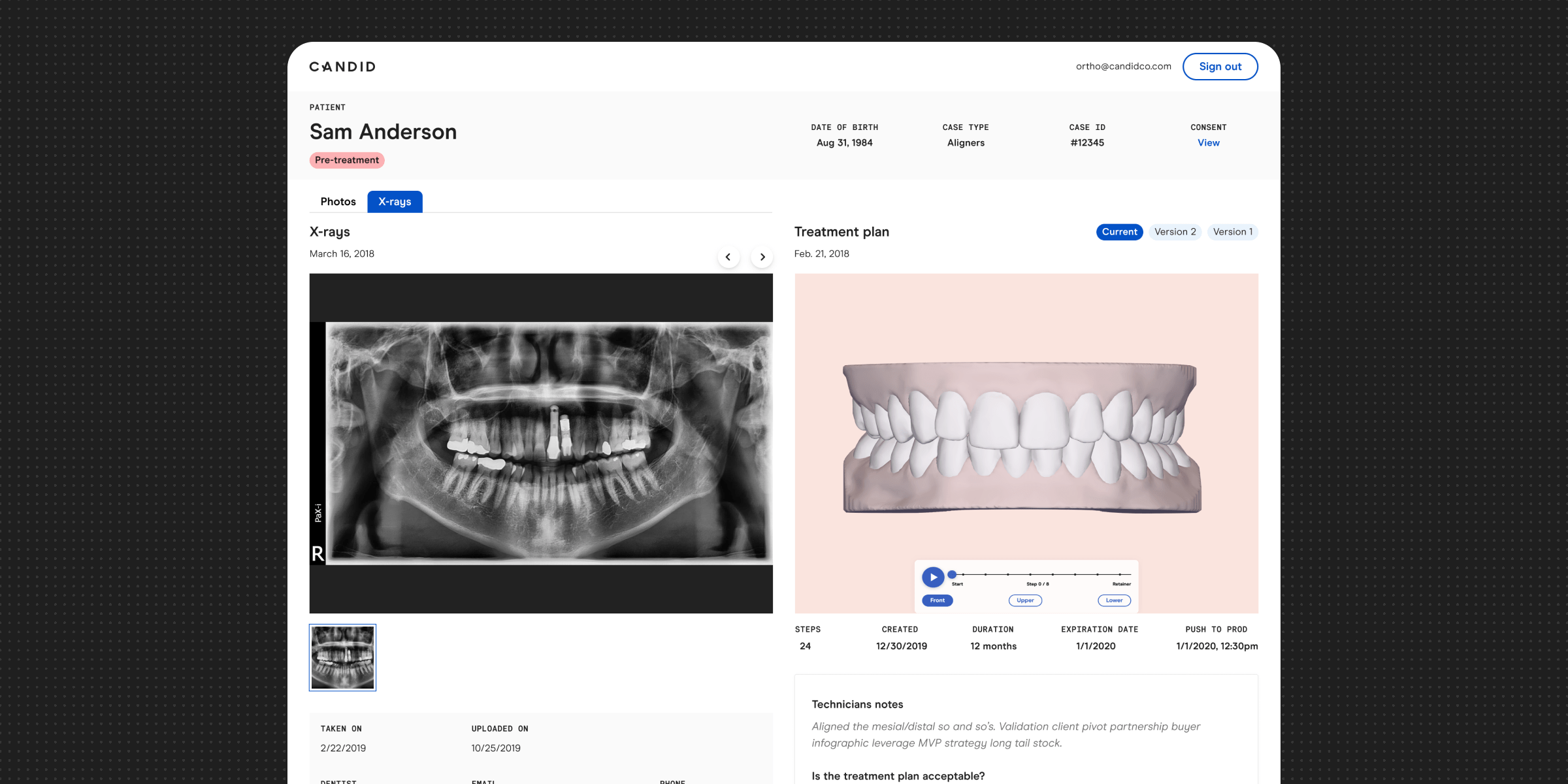 Candid Xrays Tregg Portfolio Product Designer