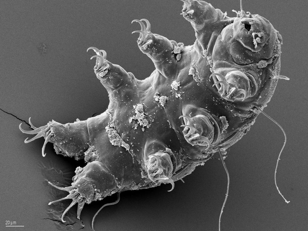 Questions about Tardigrades from the Higgins Family TREE Foundation