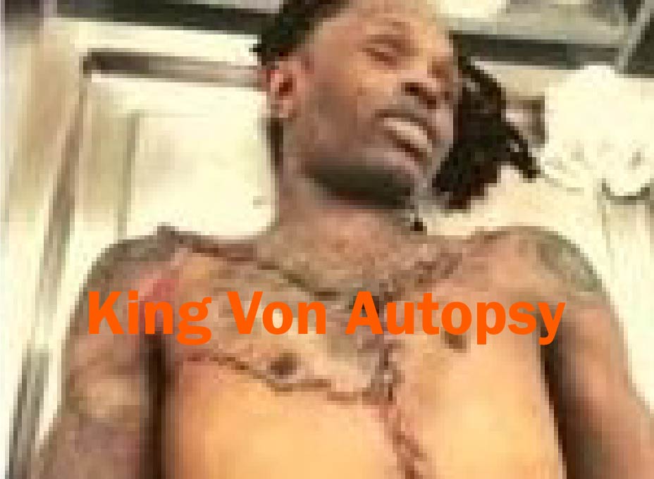 Who Is King Von Autopsy The Complete Guide Trekkers