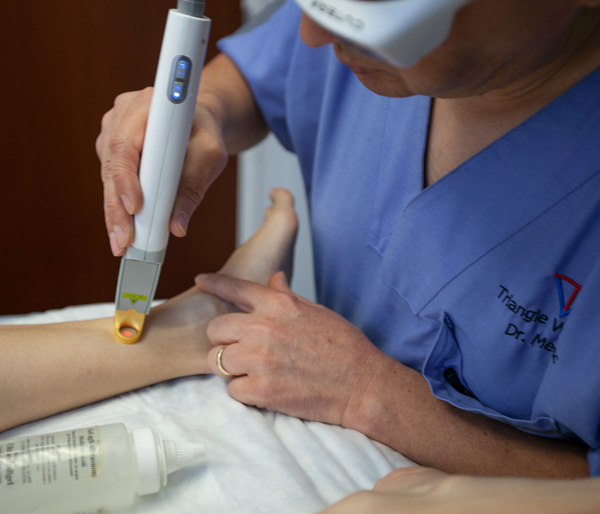 Sclerotherapy & Laser Treatments Triangle Vein Clinic Cary, NC