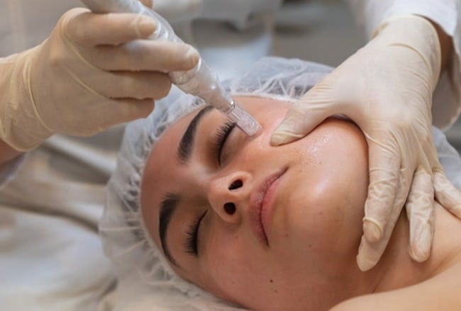 Taking Microneedling to the Next Level Microneedling Treatment NYC