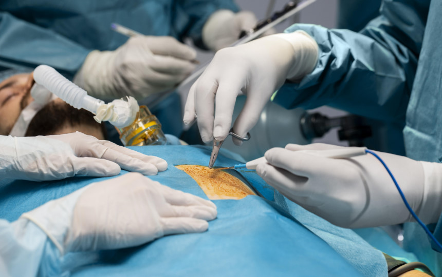 What is Minimally Invasive Cardiac Surgery Benefits of MICS