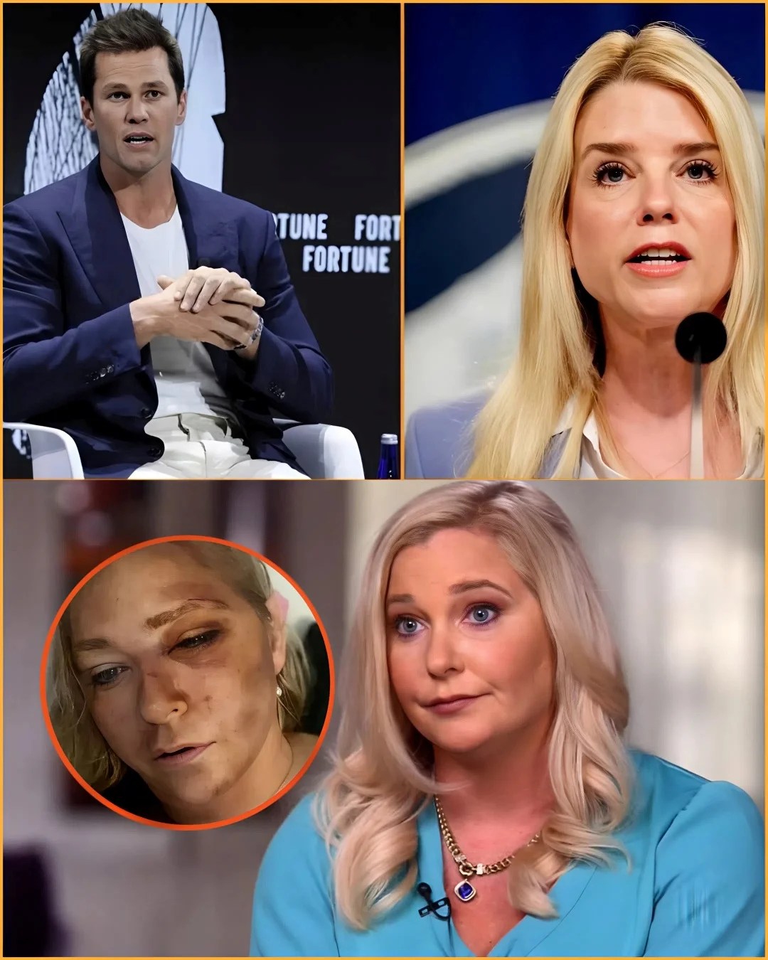 TOM BRADY “LOSES CONTROL” AS HE CALLS OUT PAM BONDI LIVE ON CBS
