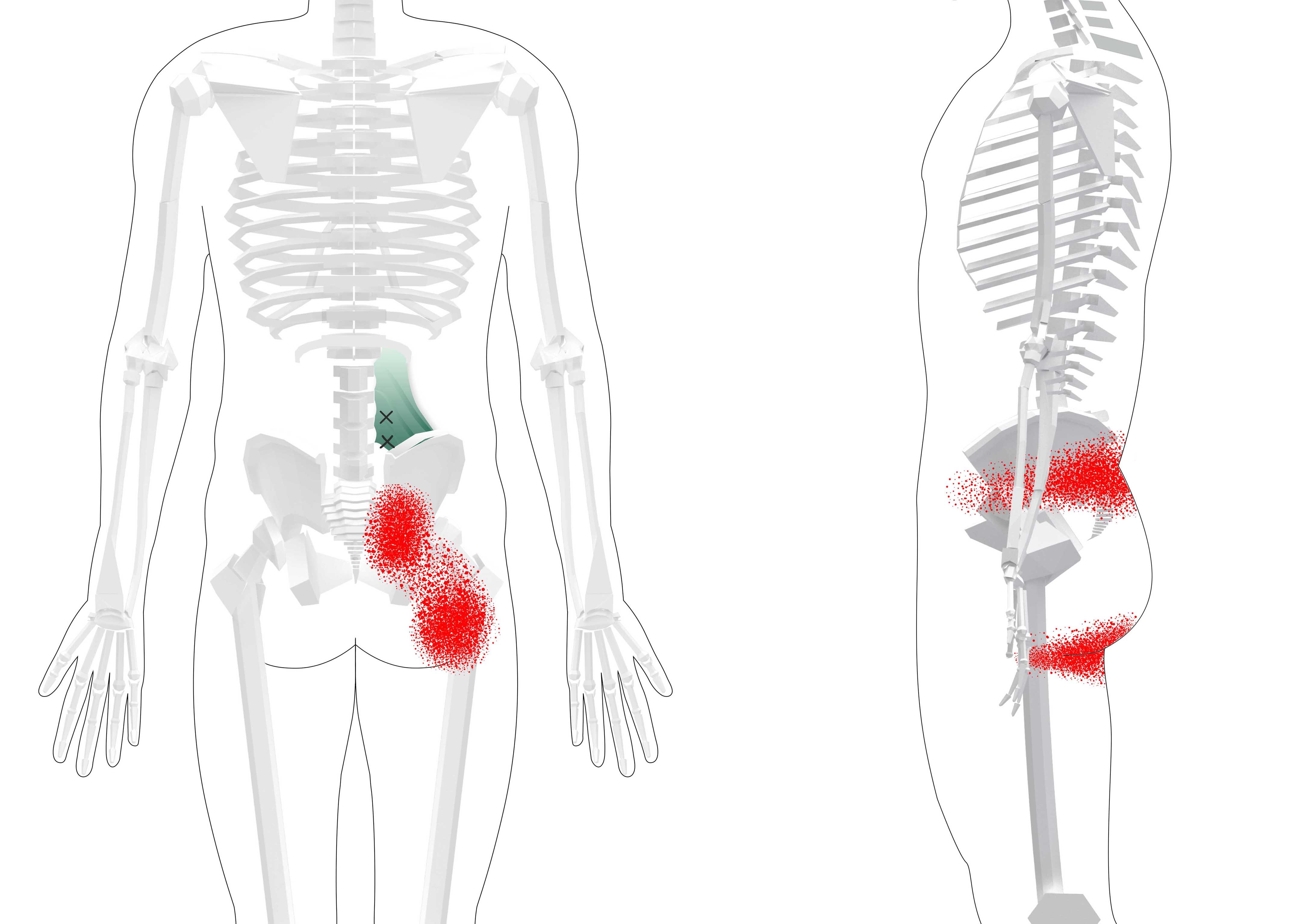 Lower Back Trigger Points (Overview + Tips and Exercises)