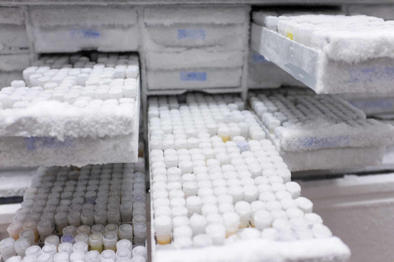 Sperm Storage/Banking » Trinidad & Tobago IVF & Fertility Centre