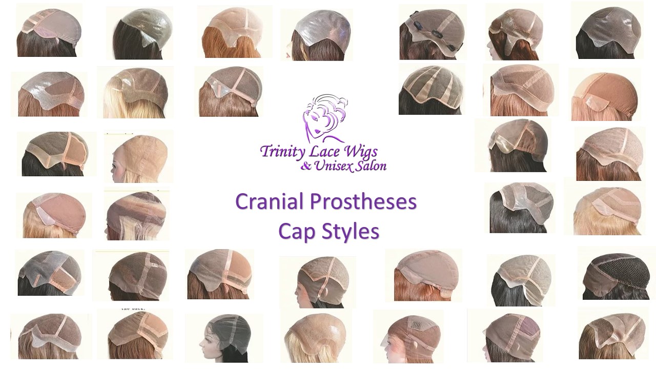 It's not a wig it is a full cranial prosthesis. Medical hair loss? We can help.