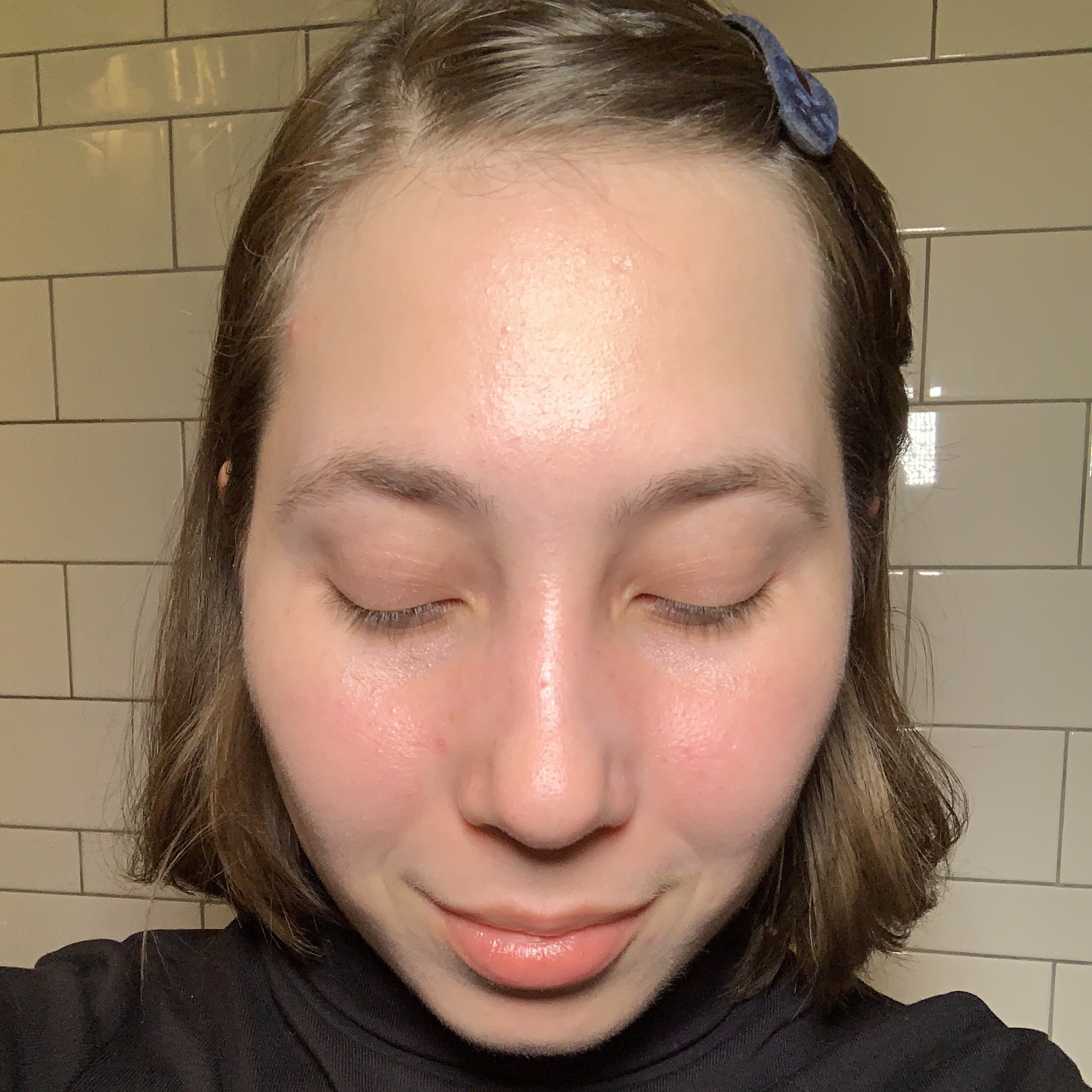 Using The Ordinary Mandelic Acid Before and After Tropical Statement