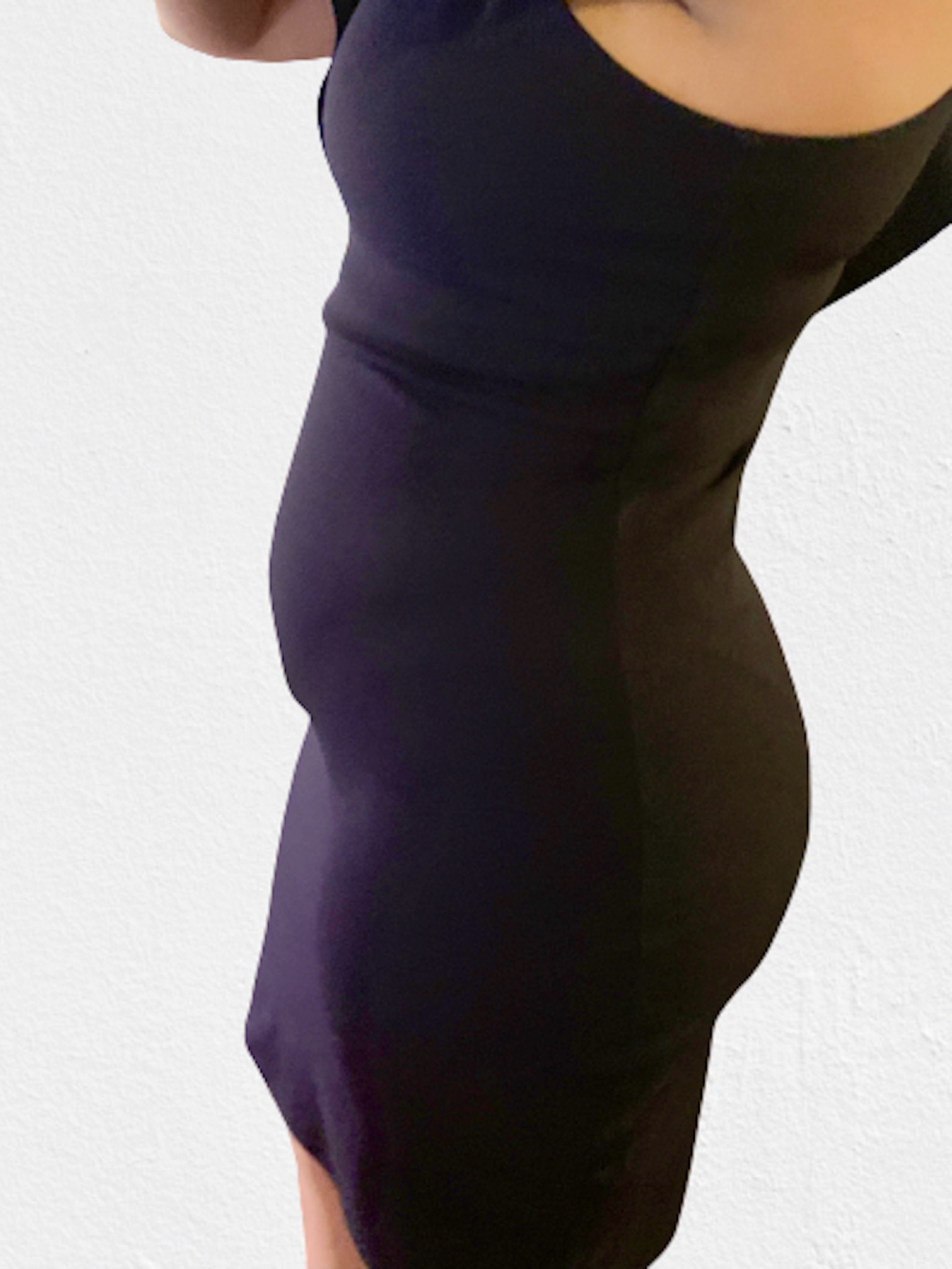 Skims Shapewear Review Before and After Tropical Statement