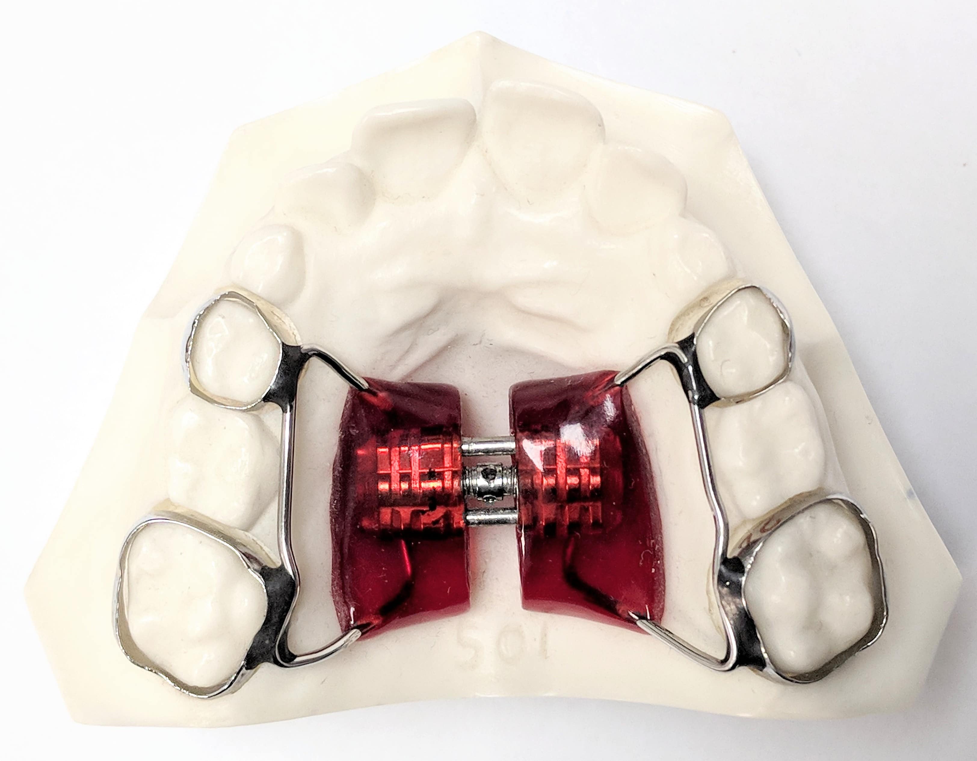 expander True Orthodontics, PC