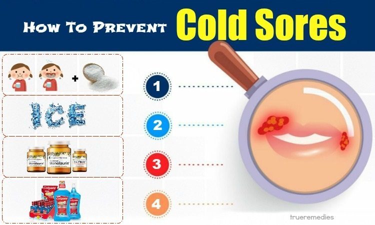 tamigardnerdesign How To Prevent A Cold Sore On Lip