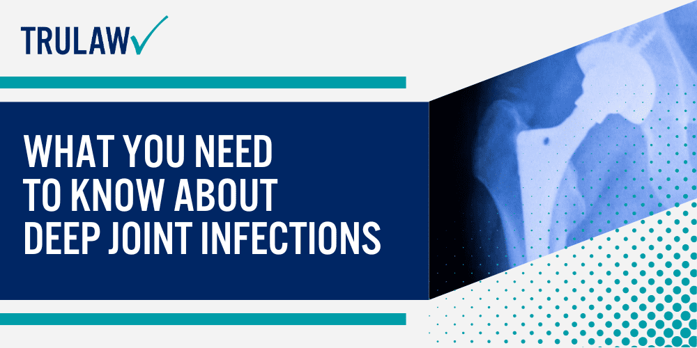 Bair Hugger Warming Blanket Lawsuit [May 2024 Update]