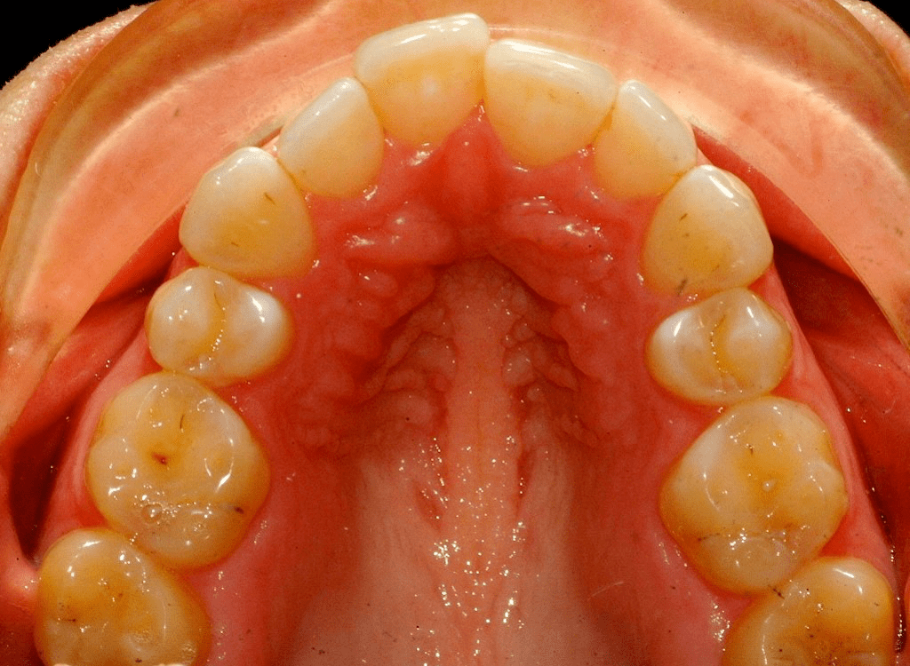 © 2005-2020 Fabdent Products and Services Pty Ltd